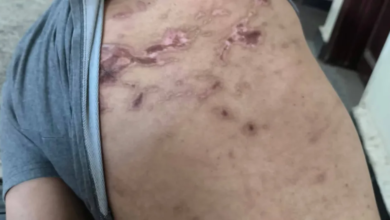 اتهامات للقوات الإماراتية بانتهاكات في اليمن: حقائق وسجون سرية