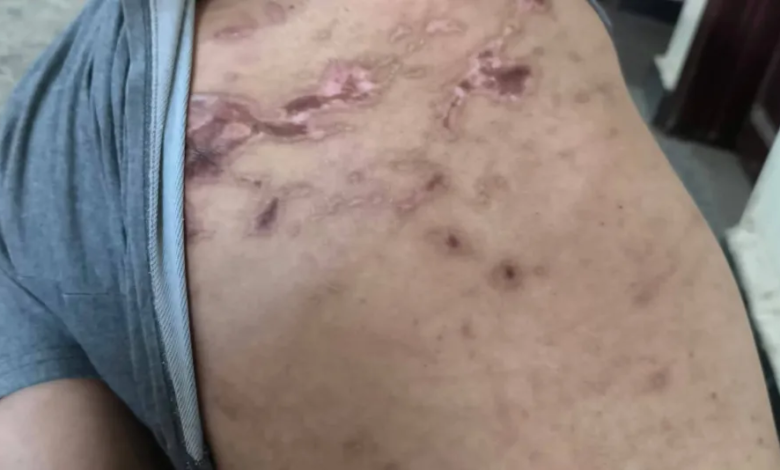 اتهامات للقوات الإماراتية بانتهاكات في اليمن: حقائق وسجون سرية