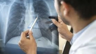 دراسة: العفن المنزلي يدمر رئات الأطفال لسنوات طويلة