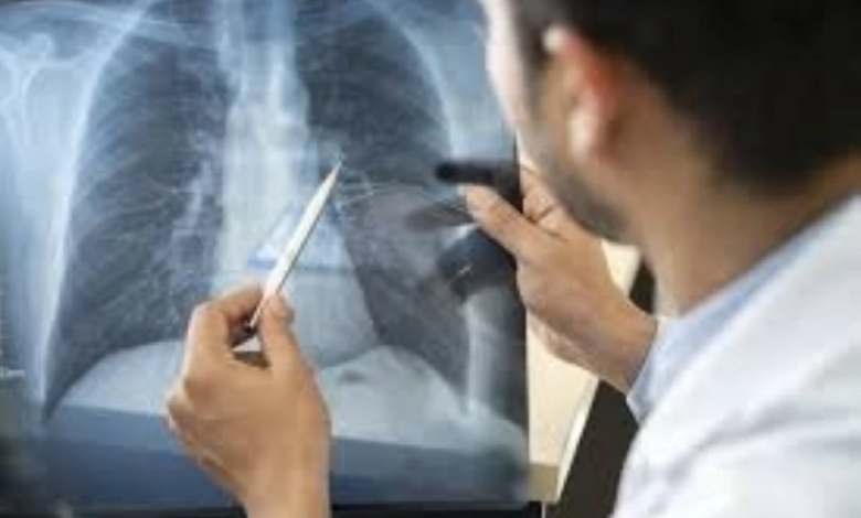 دراسة: العفن المنزلي يدمر رئات الأطفال لسنوات طويلة