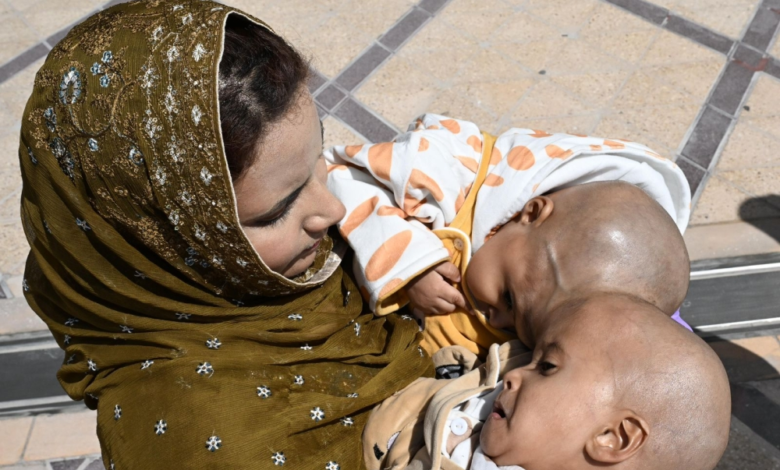 وصول التوأم الباكستاني سفيان ويوسف إلى الرياض لفصلهما