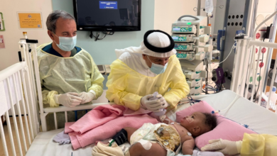 استقرار حالة التوأم الصومالي رحمة ورملا بعد عملية الفصل