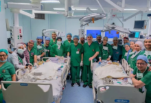 نجاح فصل توأم سيامي فلبيني بالسعودية في عملية معقدة