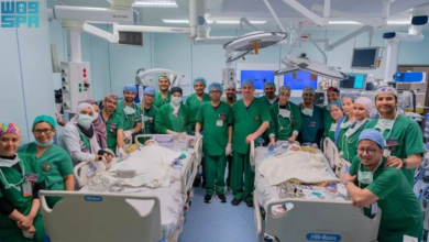 نجاح فصل توأم سيامي فلبيني بالسعودية في عملية معقدة