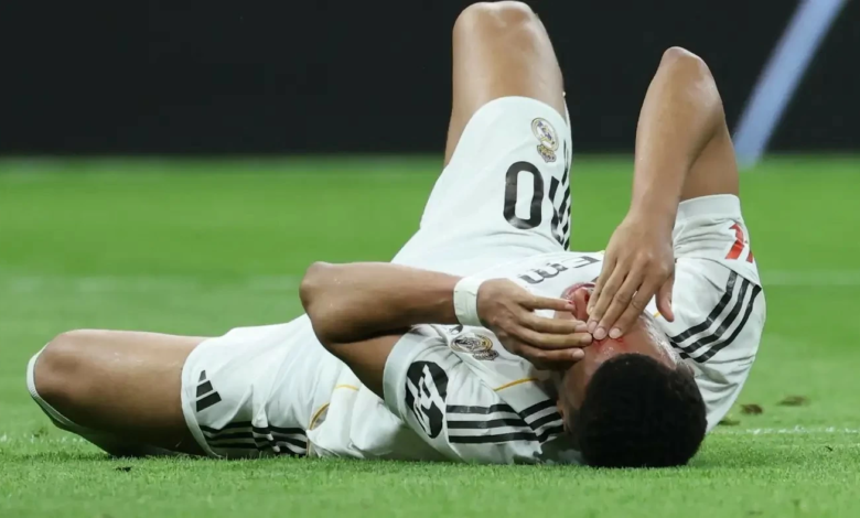 إصابة مبابي وموقفه من مباراة ريال مدريد وبايرن ميونخ