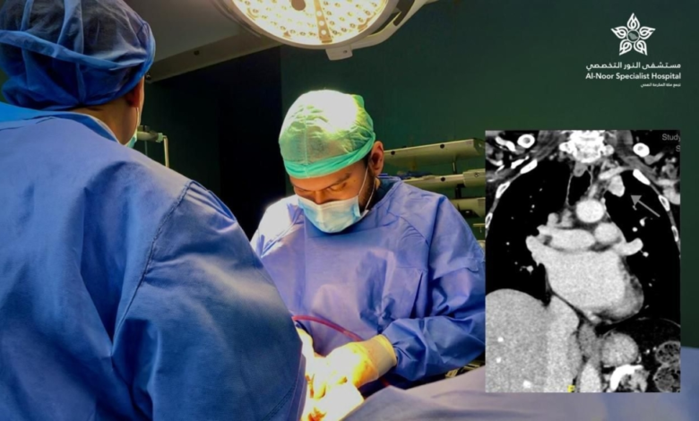استئصال أورام الرئة بالمنظار في مكة: إنجاز بمستشفى النور