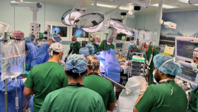 نجاح فصل توأم فلبيني ملتصق في السعودية بعد جراحة معقدة