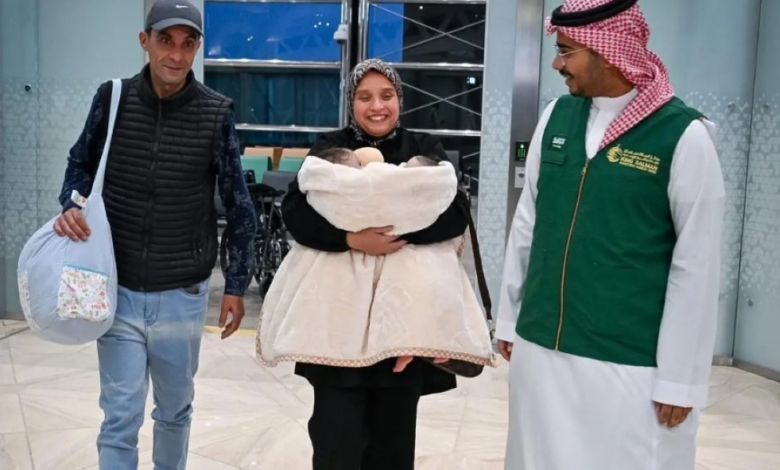 وصول التوأم السيامي المغربي سجى وضحى إلى السعودية لعملية فصل