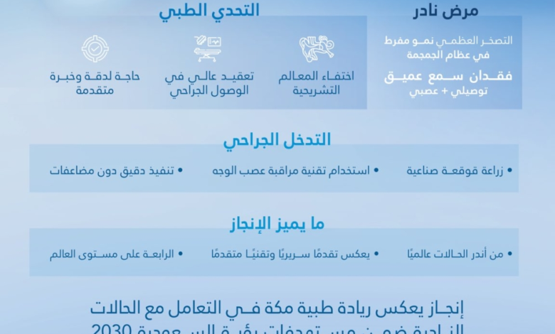 مدينة الملك عبدالله الطبية تنجح بزراعة قوقعة هي الرابعة عالميًا