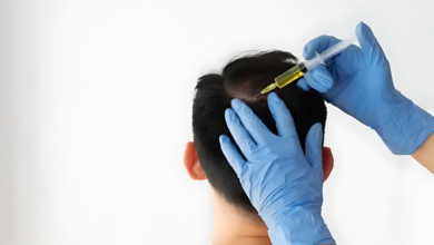 غرامات وسجن لمخالفي زراعة الشعر في السعودية | وزارة الصحة