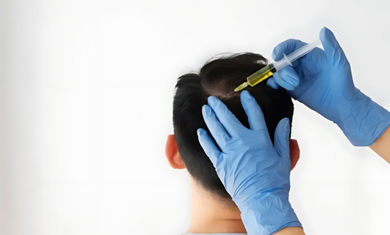 غرامات وسجن لمخالفي زراعة الشعر في السعودية | وزارة الصحة