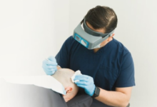 الصحة تراقب عيادات زراعة الشعر: إجراءات جديدة لحماية المرضى