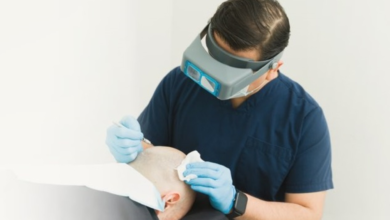 رقابة وزارة الصحة على عيادات زراعة الشعر بالسعودية