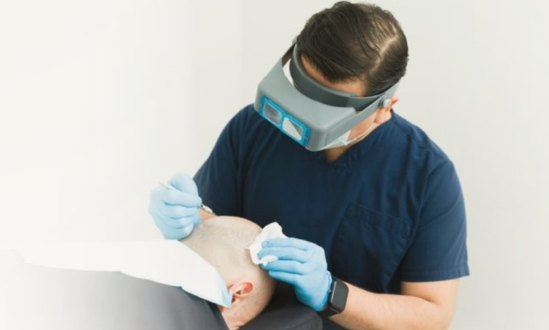 رقابة وزارة الصحة على عيادات زراعة الشعر بالسعودية