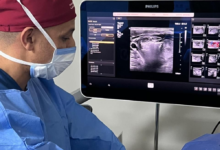 علاج أورام الغدة الدرقية دون جراحة بالكي الحراري في السعودية