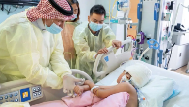 استقرار حالة التوأم الفلبيني بعد جراحة فصل ناجحة في السعودية