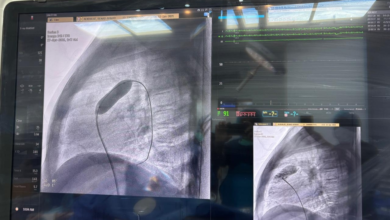 نجاح أول قسطرة قلب للأطفال في القريات: إنجاز طبي كبير