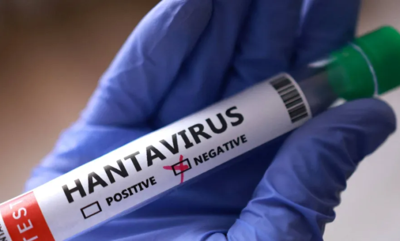 Hantavirus in Saudi Arabia: Risk assessment and prevention measures