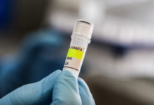 France records its first case of Hantavirus: Symptoms and prevention