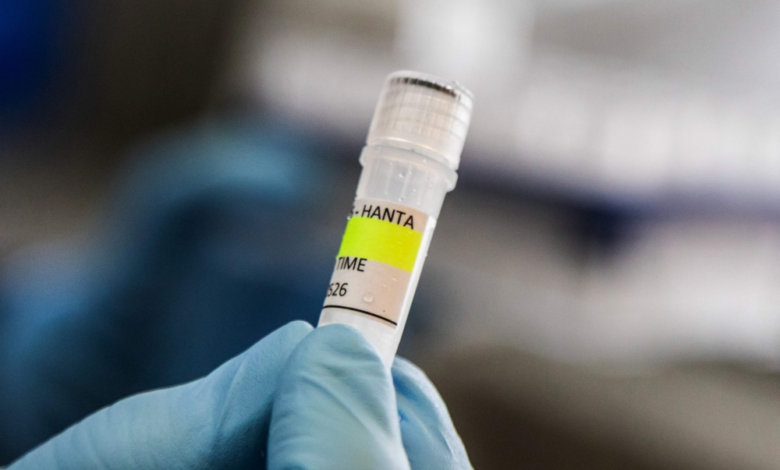 First case of Hantavirus in France: Symptoms and risk of infection