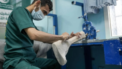 مركز الأطراف الصناعية في مأرب: خدمات ودعم لـ 497 مستفيدًا