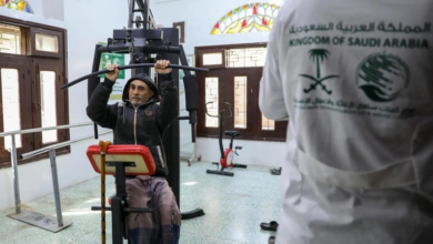 مركز الأطراف الصناعية في تعز: أمل جديد لآلاف المتضررين