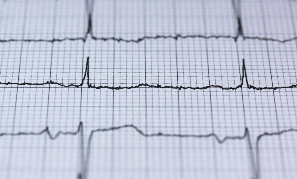 زلزال بقوة 5.9 ريختر يضرب منطقة فلوريس بإندونيسيا - مشاع إبداعي