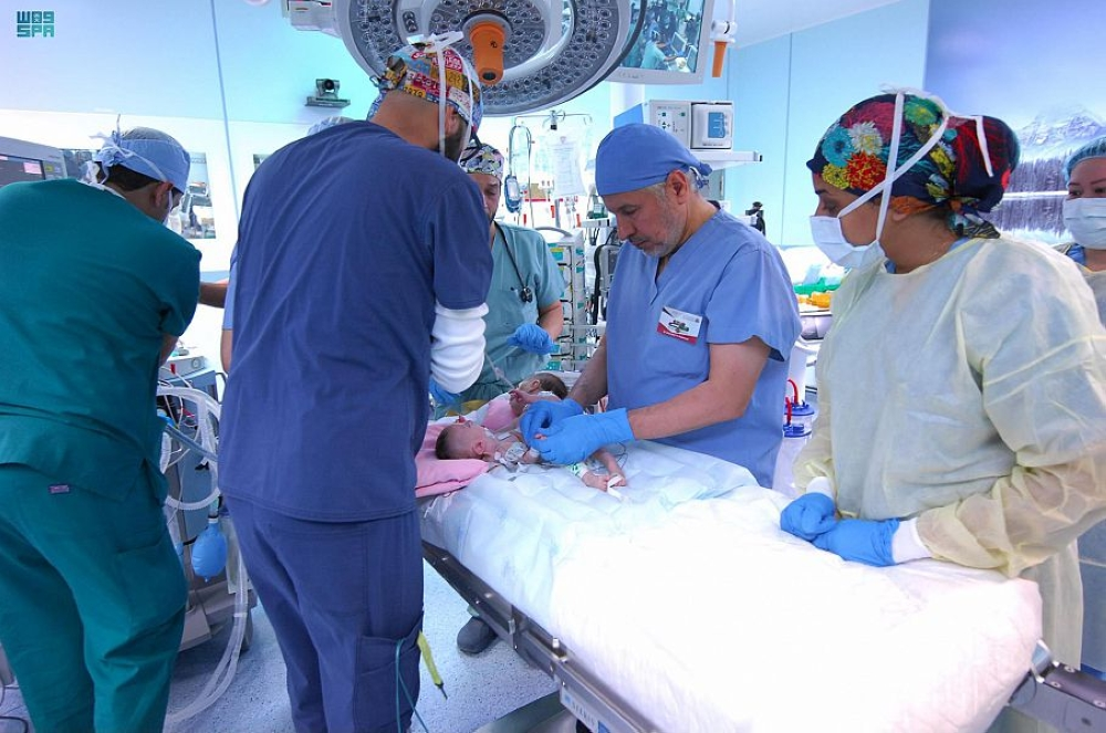 المملكة تعزز مكانتها العالمية في فصل التوائم الملتصقة - واس